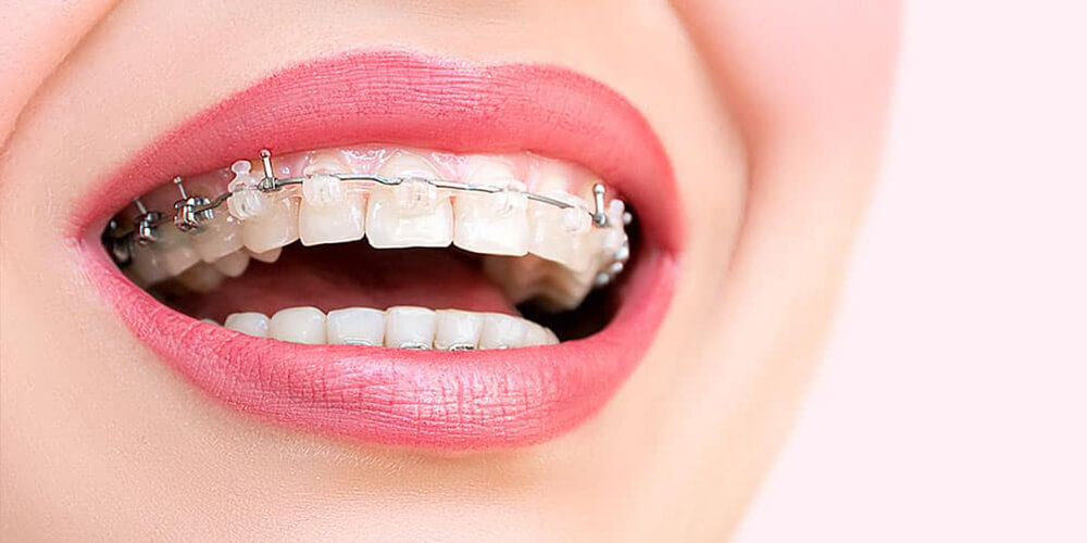 orthodontic treatment in sayan