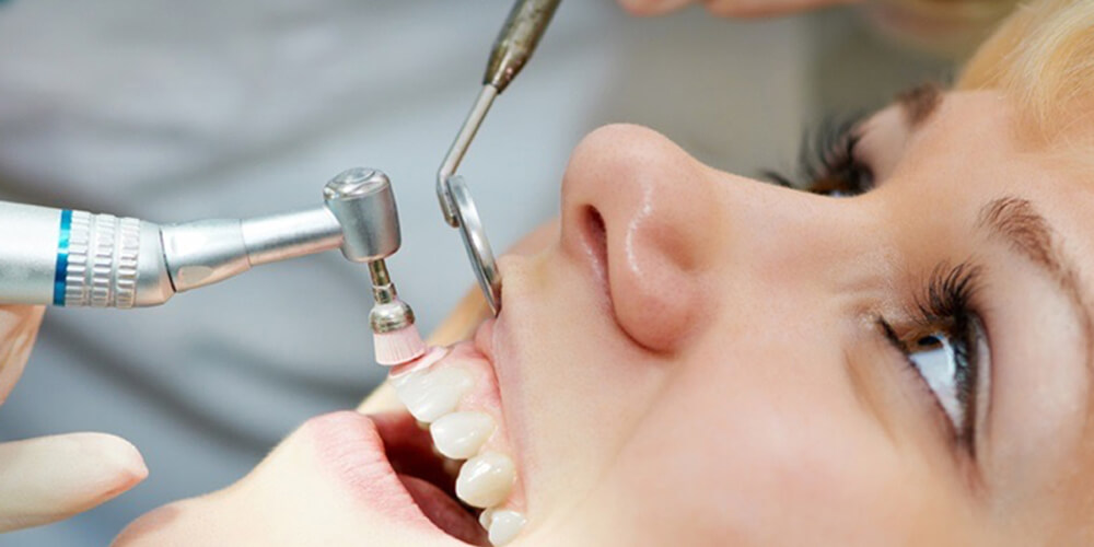 teeth cleaning  in sayan